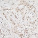 PPP3CA Polyclonal Antibody