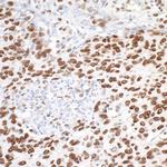 MTA1 Polyclonal Antibody