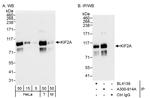 KIF2A Antibody in Western Blot (WB)