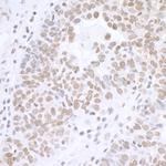 BCAS2 Polyclonal Antibody