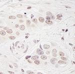 BCAS3 Polyclonal Antibody