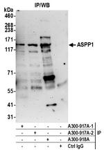 ASPP1 Polyclonal Antibody