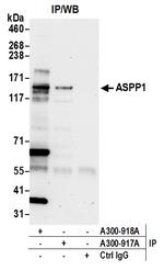 ASPP1 Antibody in Immunoprecipitation (IP)