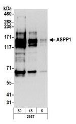 ASPP1 Polyclonal Antibody