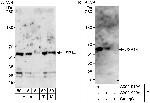 USP14 Antibody in Western Blot (WB)