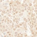 MCAK Antibody in Immunohistochemistry (Paraffin) (IHC (P))