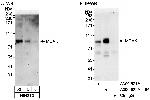 MCAK Antibody in Western Blot (WB)
