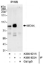 MCAK Antibody in Immunoprecipitation (IP)