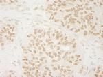 USP33 Polyclonal Antibody