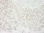 USP37 Polyclonal Antibody