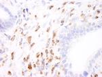 Coronin 1 Polyclonal Antibody