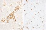 Coronin 1 Polyclonal Antibody