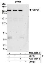 USP24 Antibody in Immunoprecipitation (IP)