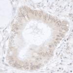 USP36/DUB1 Polyclonal Antibody