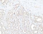 DTL/CDT2 Polyclonal Antibody