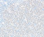 DTL/CDT2 Antibody in Immunohistochemistry (Paraffin) (IHC (P))