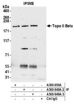 Topo II Beta Antibody in Immunoprecipitation (IP)