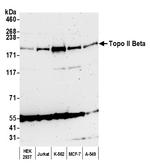 Topo II Beta Antibody in Western Blot (WB)