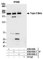Topo II Beta Antibody in Immunoprecipitation (IP)