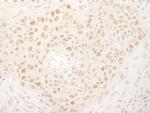 KIFC1 Polyclonal Antibody