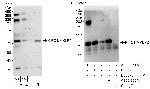 KIFC1 Antibody in Western Blot (WB)