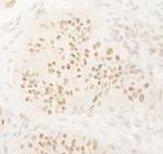 KIFC1 Polyclonal Antibody
