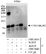 KIFC1 Antibody in Immunoprecipitation (IP)