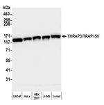 THRAP3/TRAP150 Antibody in Western Blot (WB)