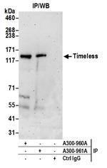 Timeless Polyclonal Antibody