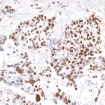 Timeless Polyclonal Antibody