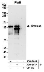 Timeless Antibody in Immunoprecipitation (IP)