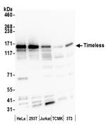 Timeless Antibody in Western Blot (WB)