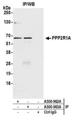 PPP2R1A Polyclonal Antibody