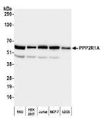 PPP2R1A Polyclonal Antibody