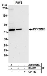 PPP2R2B Antibody in Immunoprecipitation (IP)