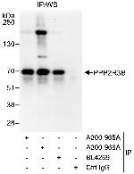 PPP2R3B Antibody in Immunoprecipitation (IP)