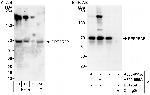 PPP2R3B Polyclonal Antibody