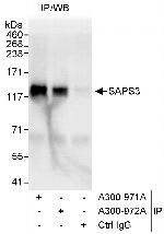 SAPS3 Polyclonal Antibody