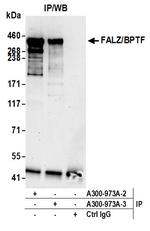 FALZ/BPTF Antibody in Immunoprecipitation (IP)