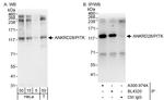 ANKRD28/PITK Antibody in Western Blot (WB)