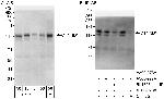 CTNND1 Antibody in Western Blot (WB)