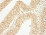 CTNND1 Antibody in Immunohistochemistry (Paraffin) (IHC (P))