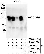 CTNND1 Antibody in Immunoprecipitation (IP)