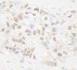 APC Polyclonal Antibody