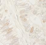 APC Polyclonal Antibody