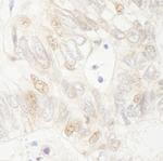 APC Polyclonal Antibody