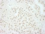 SFRS8/SWAP Polyclonal Antibody