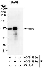 HRS Polyclonal Antibody