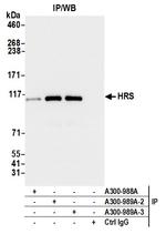 HRS Antibody in Immunoprecipitation (IP)