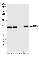 HRS Antibody in Western Blot (WB)
